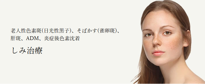 共立美容外科　シミ取り